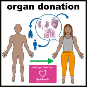 Organ donation