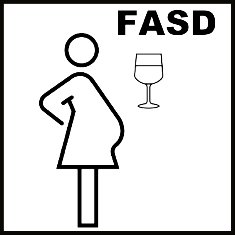 Fetal Alchohol Spectrum Disorder FASD