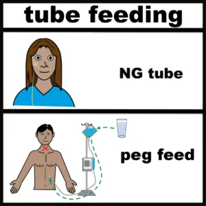 Tube feeding