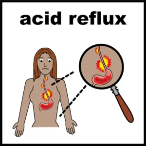 Acid reflux