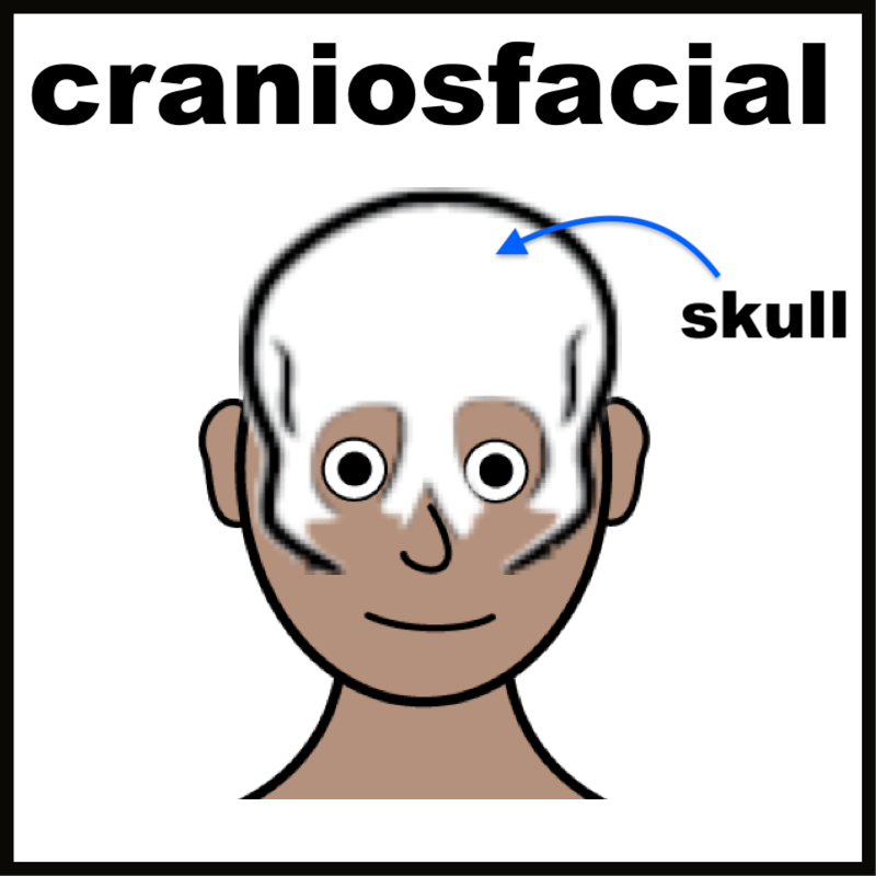 Craniofacial