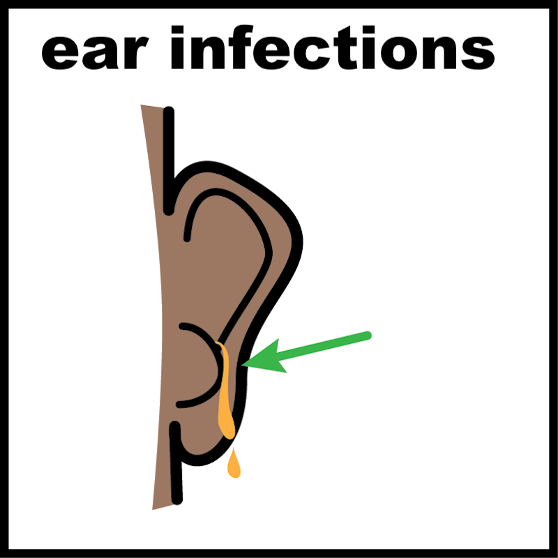 Ear infection