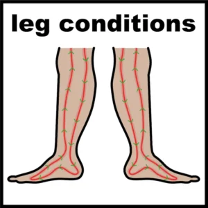 Leg conditions