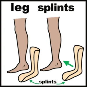 Leg splints