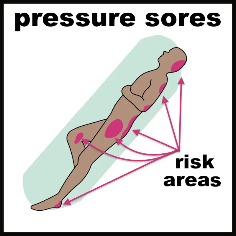 Skin pressure sores