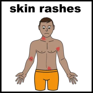 skin rash