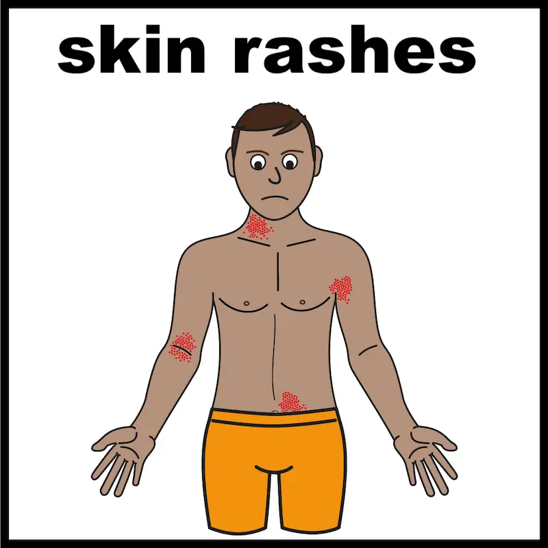 Skin rashes