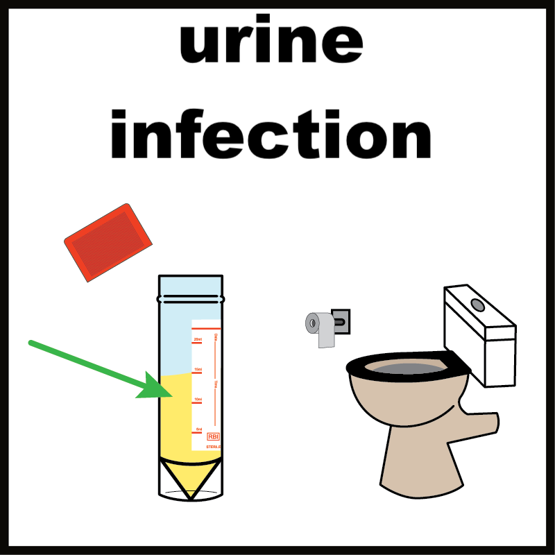 Urine Infections